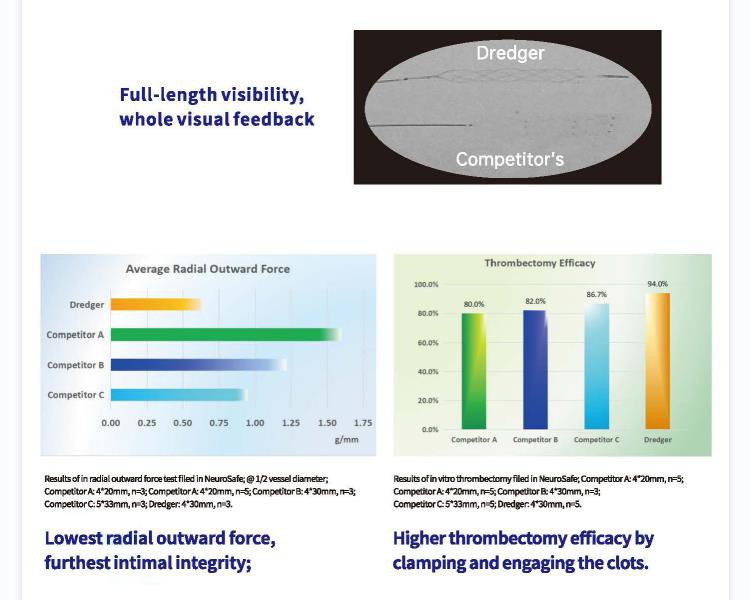 mechanical thrombectomy with stent retriever mechanical thrombectomy with stent retriever